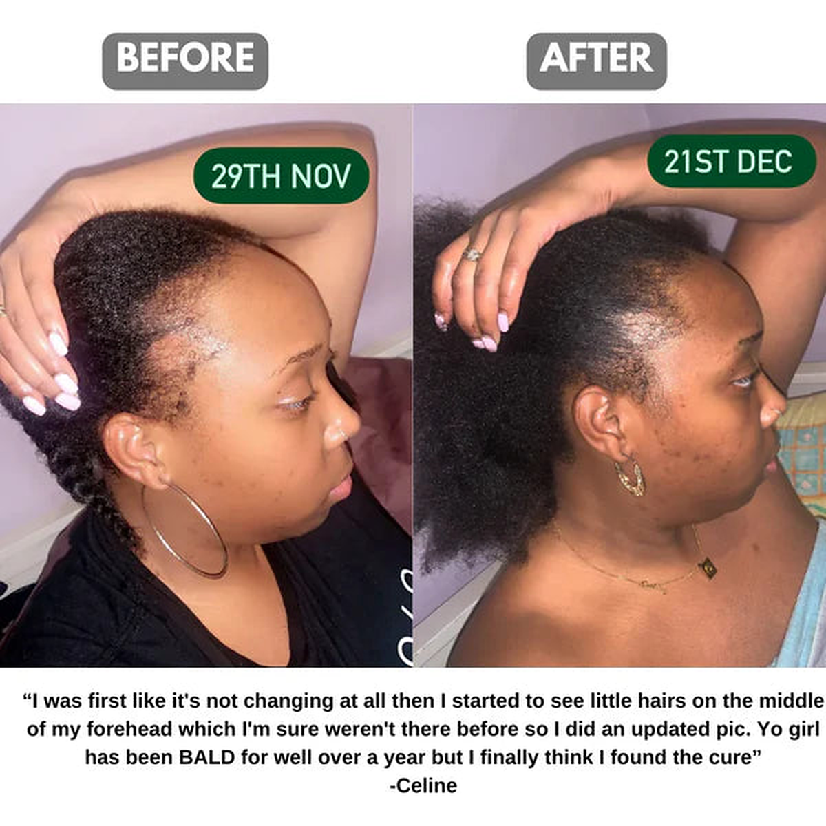 Batana oil before and after customer story