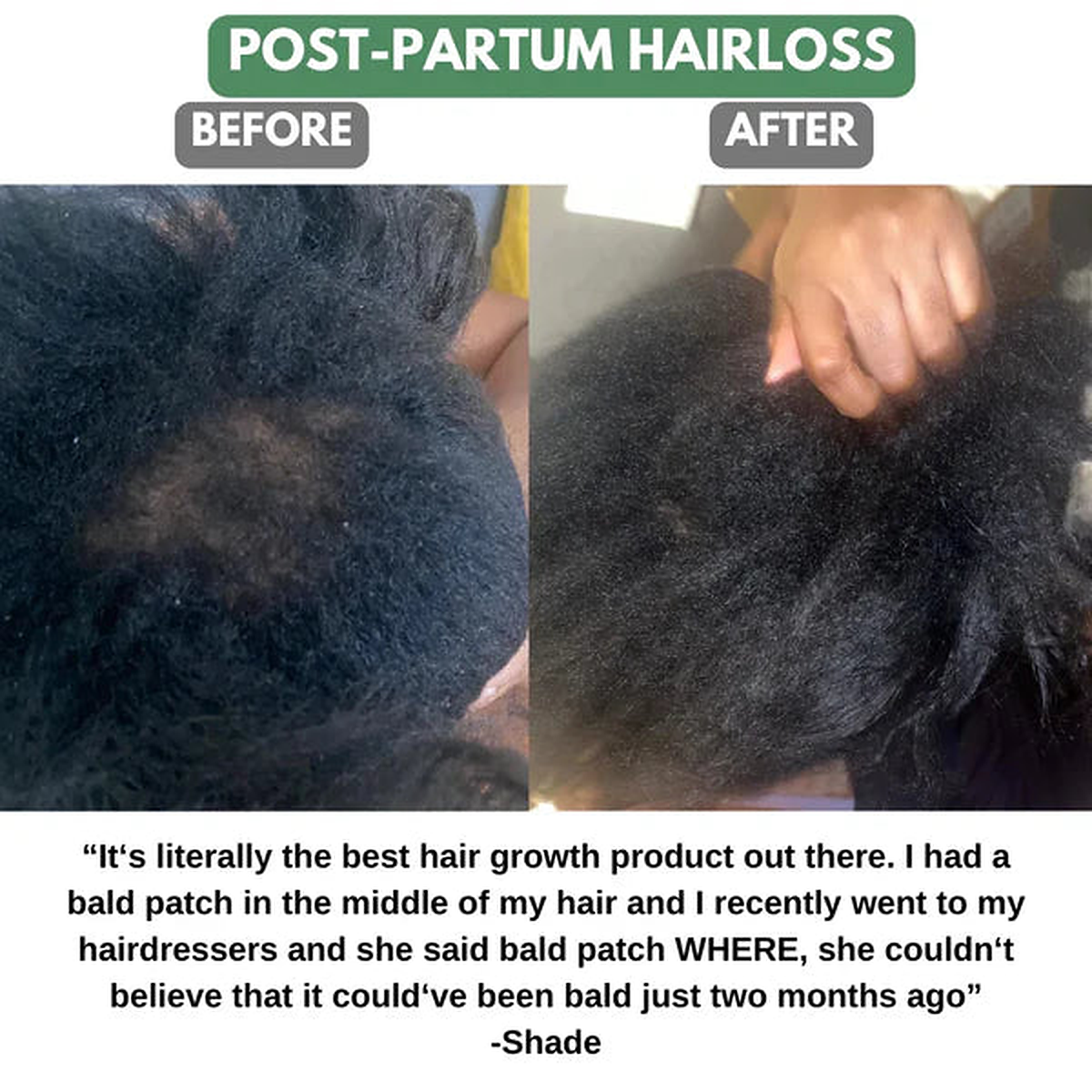 Batana oil postpartum hair customer story
